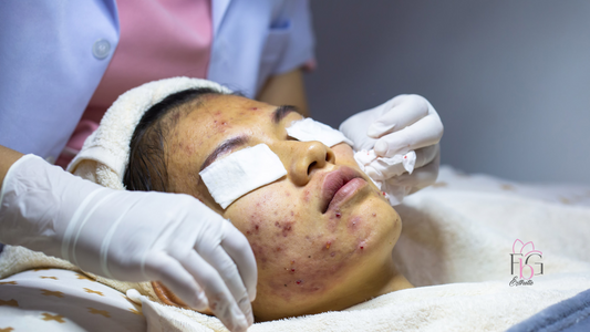 Facial Purificante