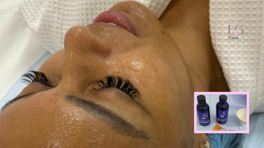 Peelings Quimicos