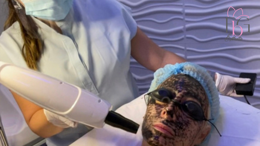 Facial Hollywood Peel